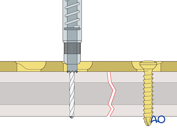 Drilling