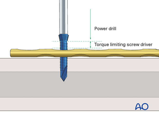 Insertion of self-drilling screw