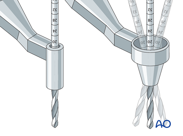 Use of drill guide