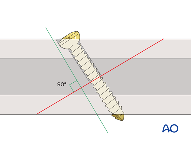 Screw axis