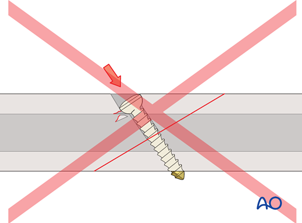 Pitfall when countersinking