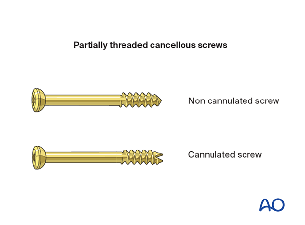 cancellous lag screws