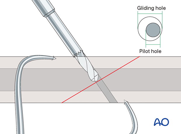 Alternative drilling technique