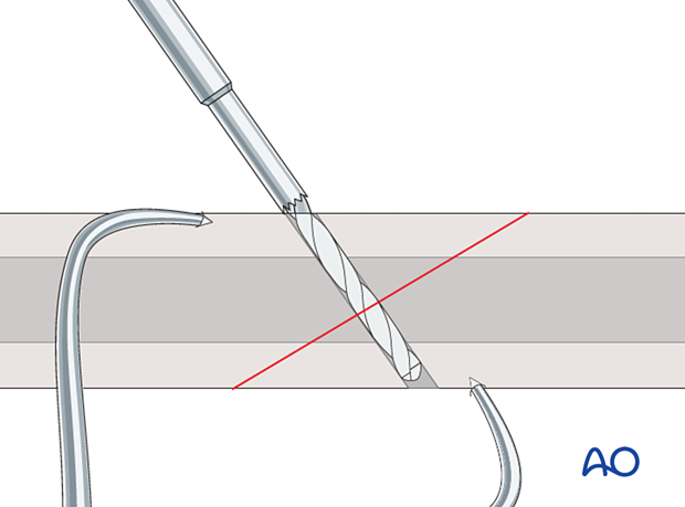 Drilling for partially threaded screw