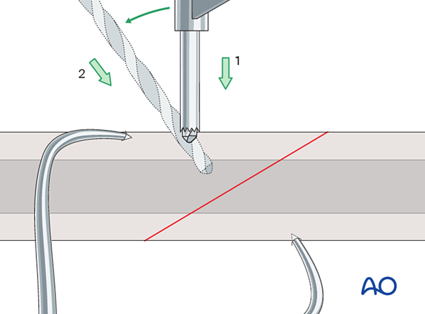 Pearl for drilling obliquely onto bone surface