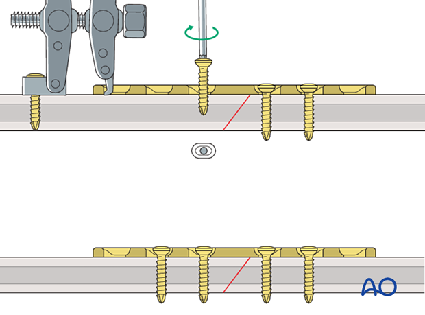 basic principles of plating