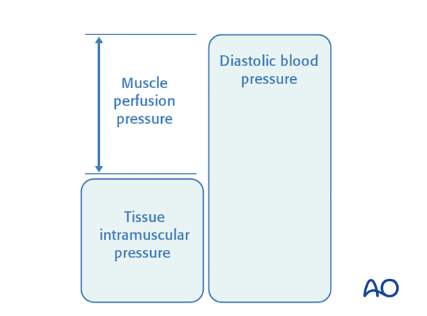 Compartment syndrome occurs when the pressure within a closed osteo-fascial muscle compartment rises above a critical level. 