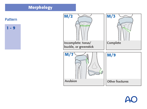 classification of childrens fractures