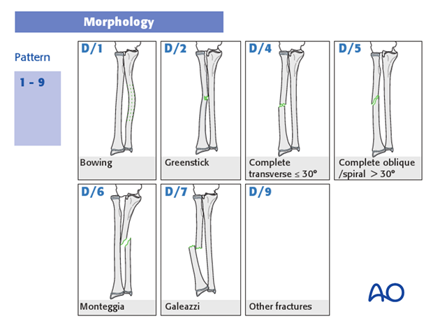 classification of childrens fractures