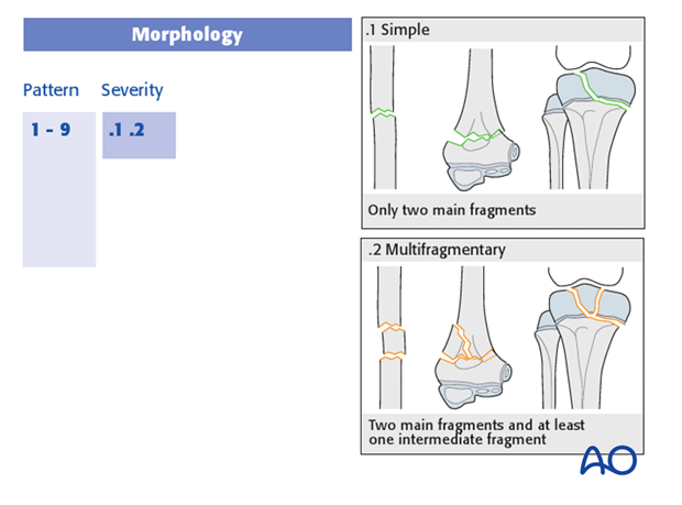 classification of childrens fractures