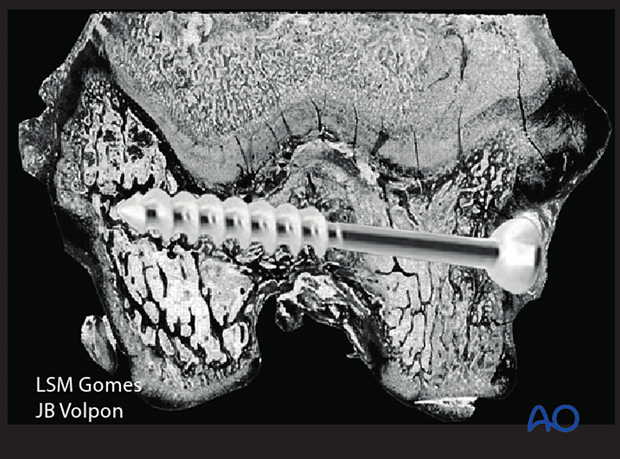 posttraumatic growth disturbance