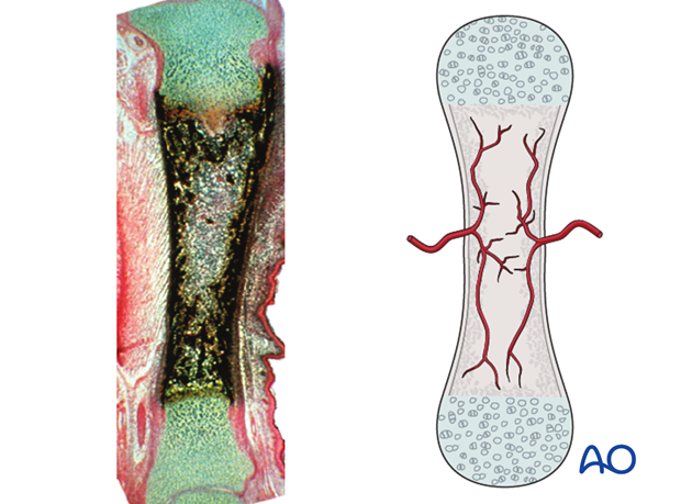 the physis