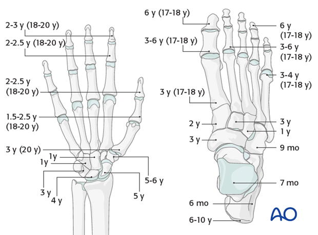 the physis