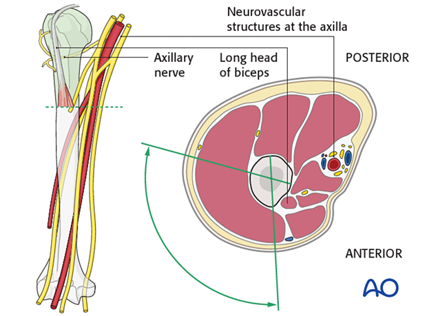 Safe zones in the proximal humerus