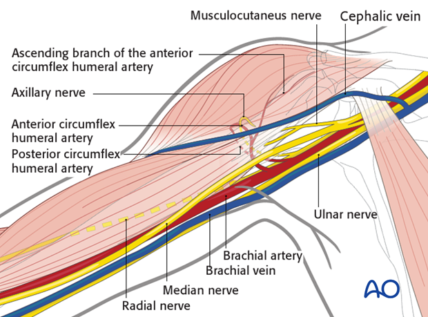 deltopectoral approach to the proximal humerus