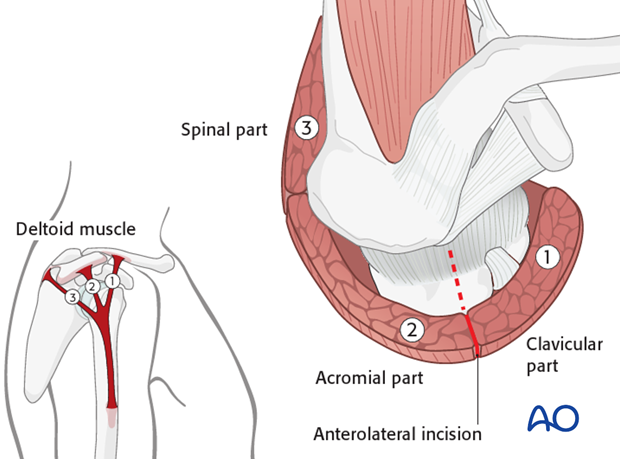 anterolateral approach