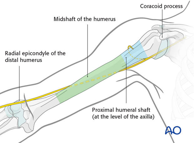 Anatomical landmarks for skin incision