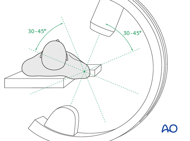 C-arm positioning