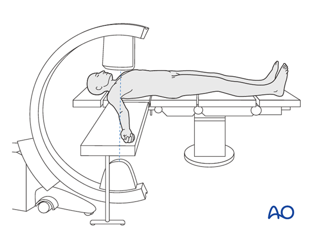 C-arm positioning