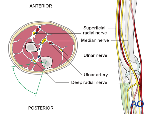 Safe zone for pin placement in the proximal forearm