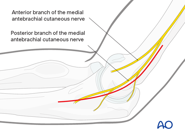 Skin incision for medial approach