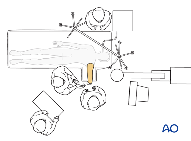 Operating room set-up with patient prone