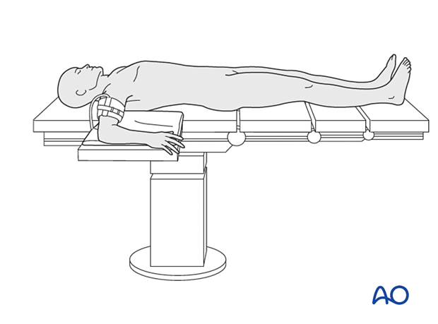 Arm position for lateral approach