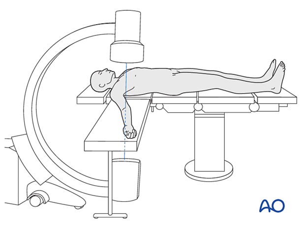 C-arm positioning 