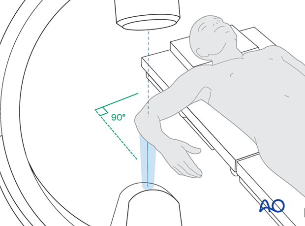 Positioning for optimal Lateral vie