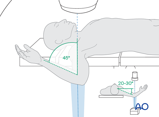 Positioning for optimal oblique view