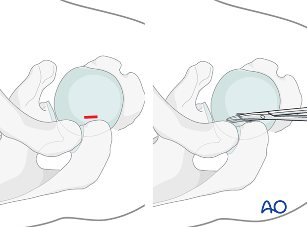 Preparation of camera portal