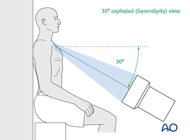 clinical and radiological examination of patients with clavicle injuries