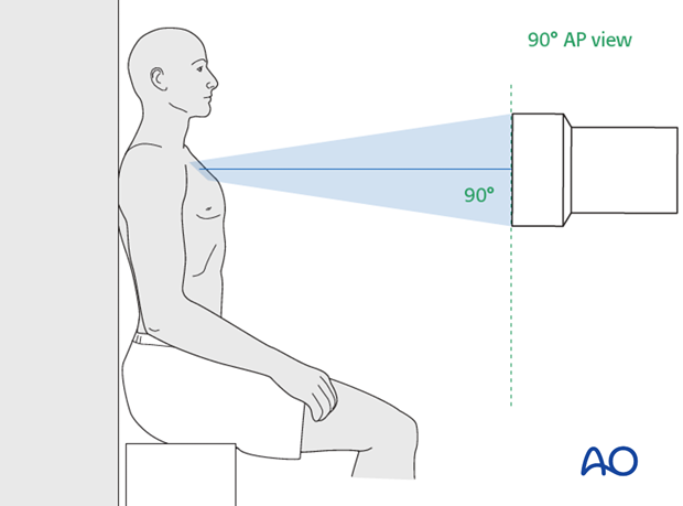 clinical and radiological examination of patients with clavicle injuries