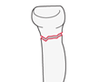 proximal forearm