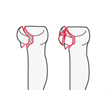 proximal forearm