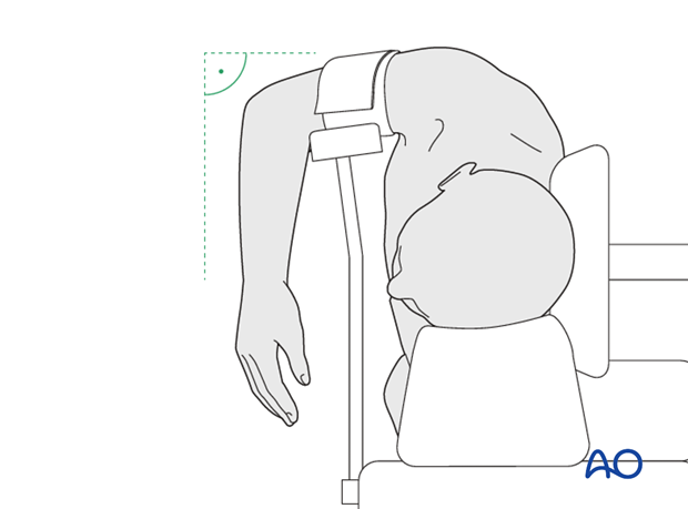 lateral decubitus position