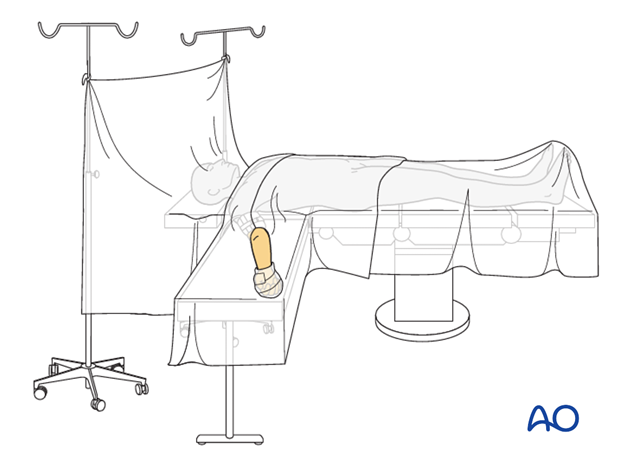 supine for anterior access