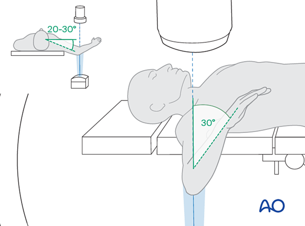 intraoperative imaging