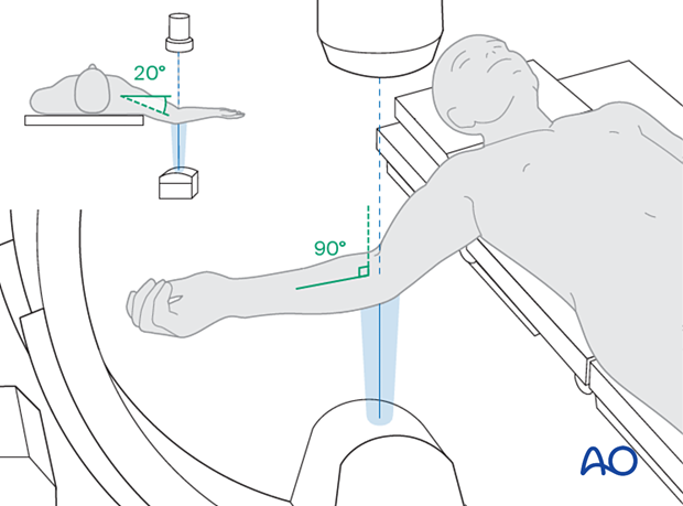 intraoperative imaging