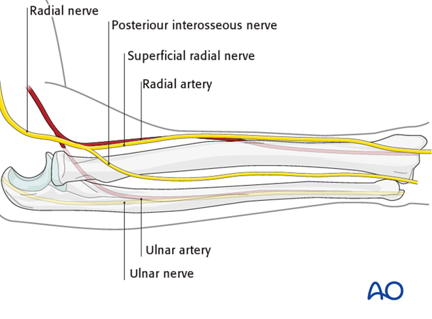 Safe zones for pin placement in the forearm