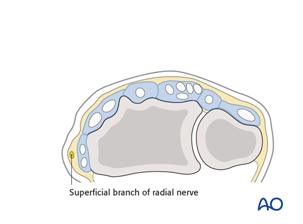 direct approach to the radial styloid