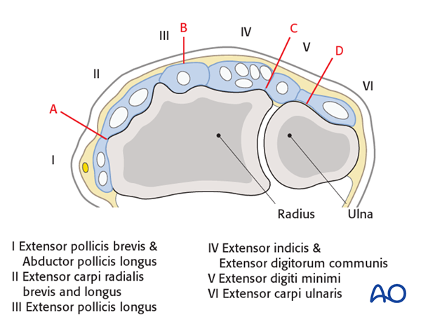 dorsal approach