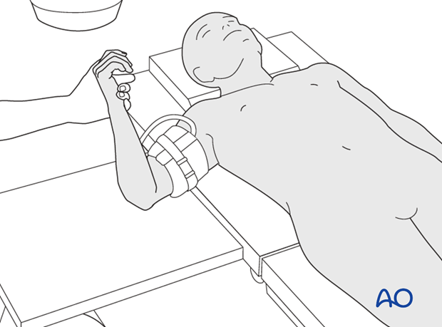 supine positioning distal ulna