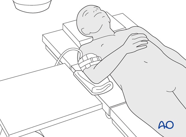 supine positioning distal ulna