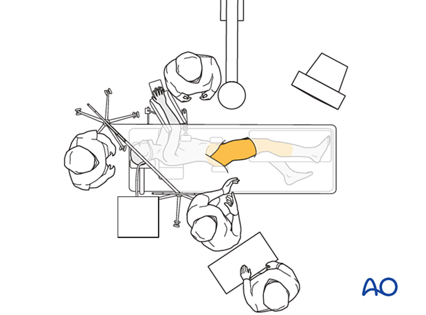 Operating room set-up with the patient in a lateral decubitus position for surgical treatment of proximal femoral fractures