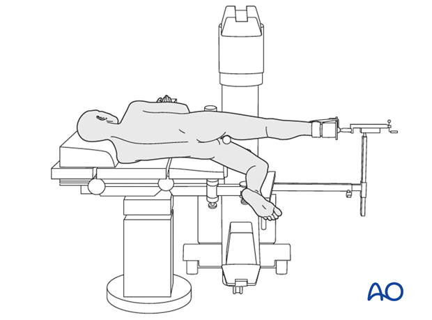 lateral decubitus position