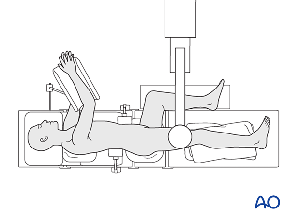 lateral decubitus position