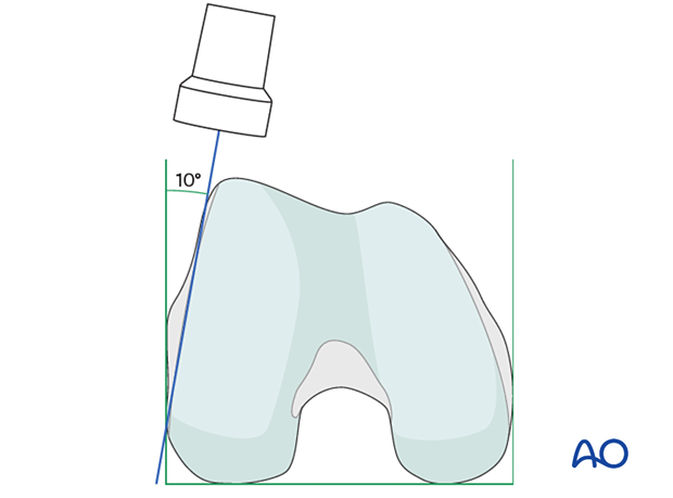 Positioning for optimal 10° internal rollover view