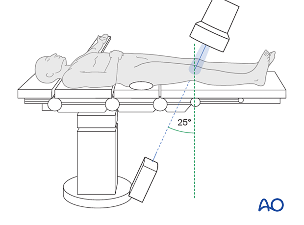 Positioning for optimal notch view