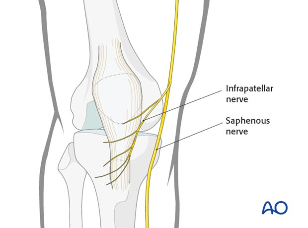 mid axial longitudinal approach